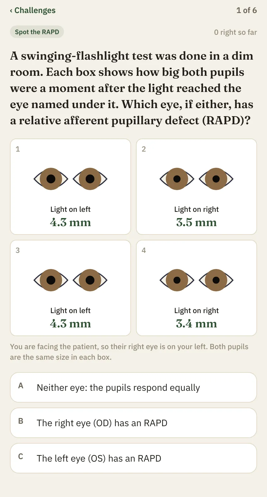 The Spot the RAPD simulator challenge with four pairs of pupils drawn at different sizes and three answer choices
